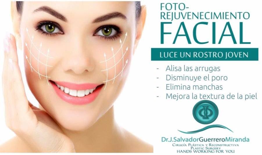 Foto rejuvenecimiento facial en reynosa