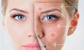 Tratamientos Integrales